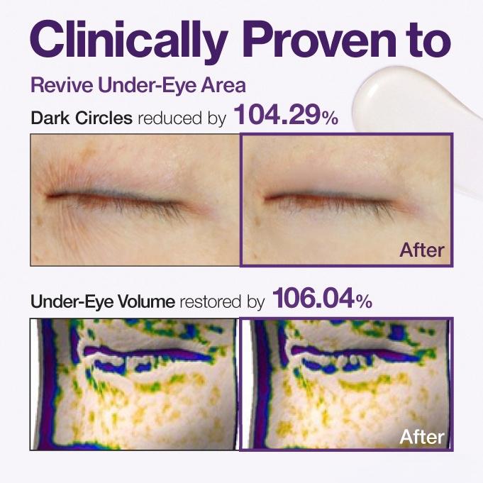 🔥Insideefy™ Firm & Bright Eye Cream-with NAD+, Peptides, and Retinol, Targeting Dark Circles, Wrinkles, and Puffiness