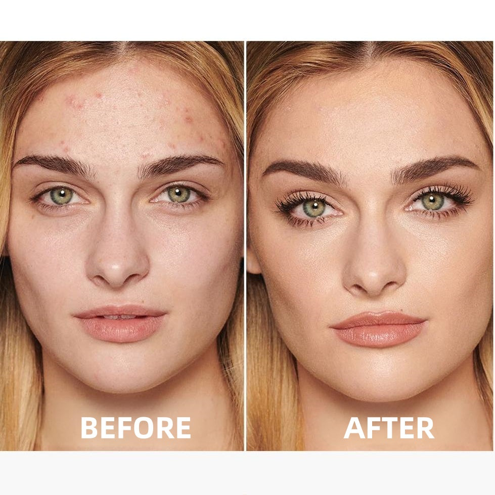 🔥Medazy™ Nourishing Skincare BB Cream-Flawless Coverage, Oil Control & SPF20