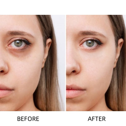 🔥Insideefy™ Revitalizing Eye Cream – Brightening, Firming & Anti-Aging