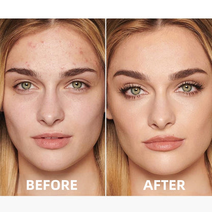 🔥Insideefy™ All-Day Perfection Concealer-Hydrating, Long-lasting Coverage & Natural Finish