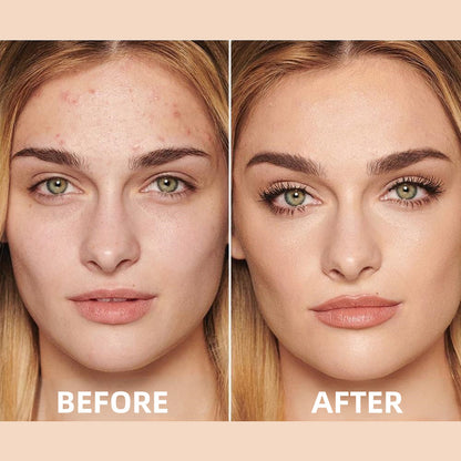🔥Medazy™ Hydrating Concealer– Seamless Coverage & Deep Moisture