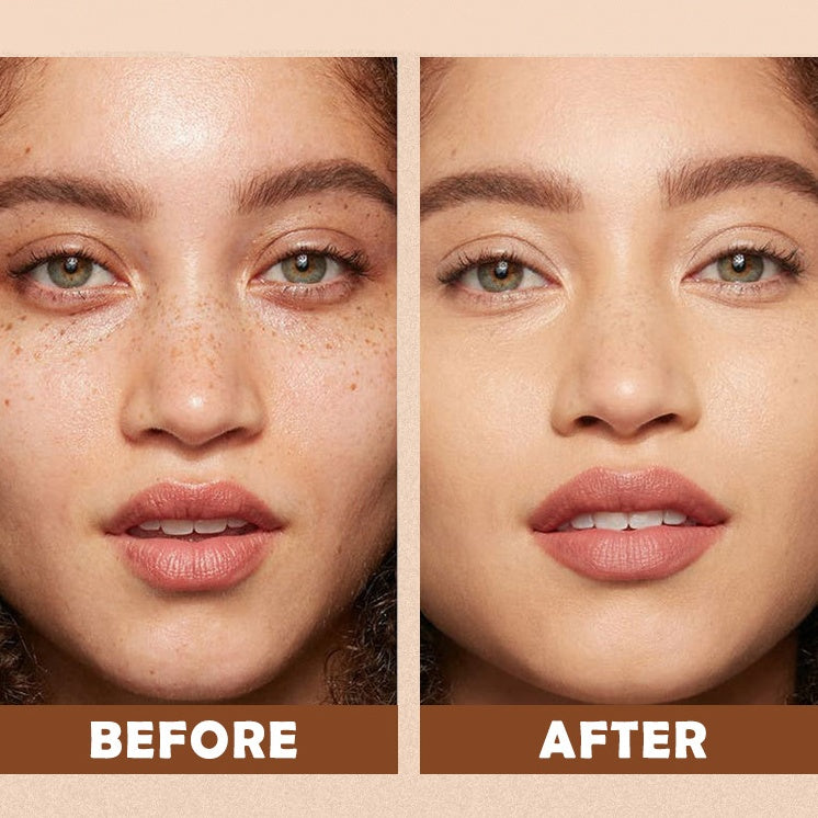 🔥Medazy™ Hydrating Concealer– Seamless Coverage & Deep Moisture