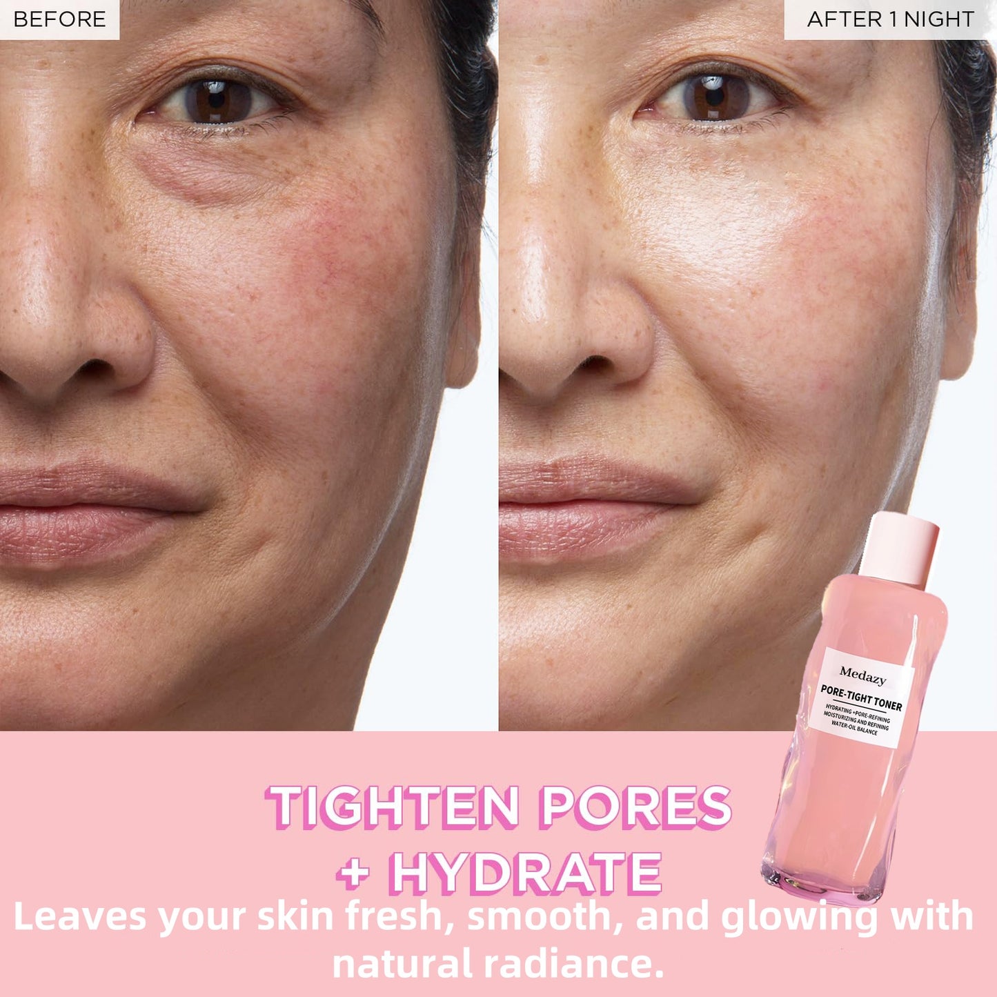 🔥Medazy™ PHA + BHA Pore-Tight Toner – Exfoliate, Tighten & Hydrate