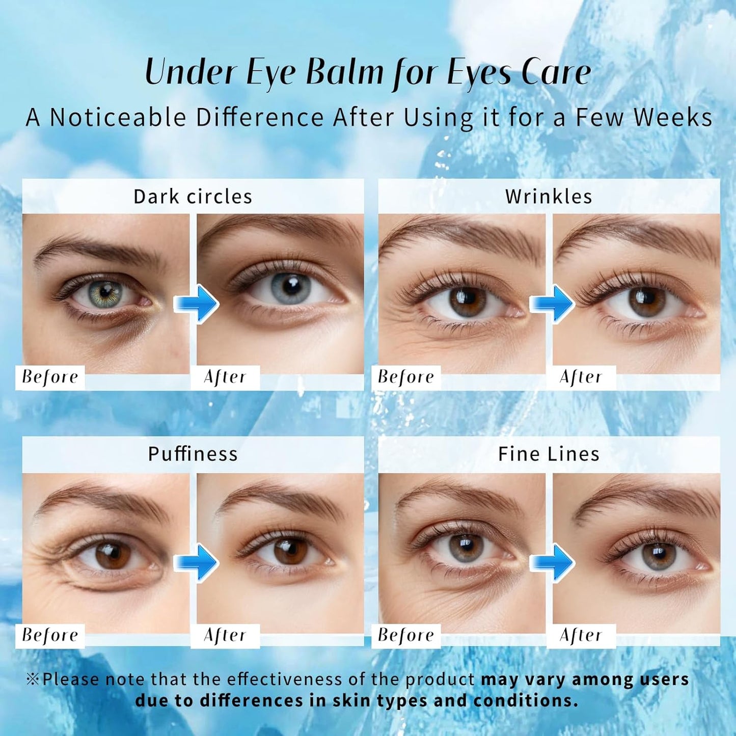 Medazy™ Vital Boost Firming Eye Balm – Instant Lift, Smooth Wrinkles & Deep Hydration✨
