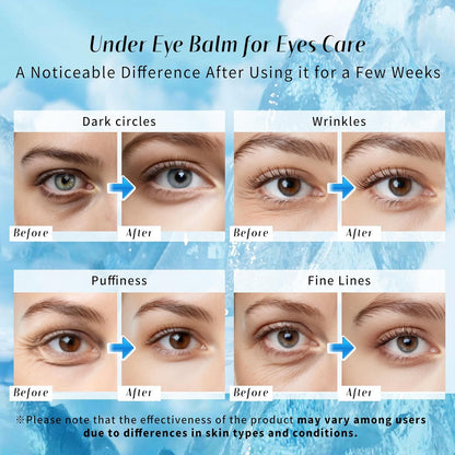 Medazy™ Vital Boost Firming Eye Balm – Instant Lift, Smooth Wrinkles & Deep Hydration✨
