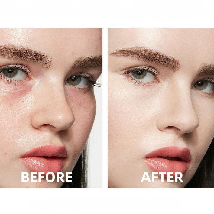 🔥Insideefy™ All-Day Perfection Concealer-Hydrating, Long-lasting Coverage & Natural Finish
