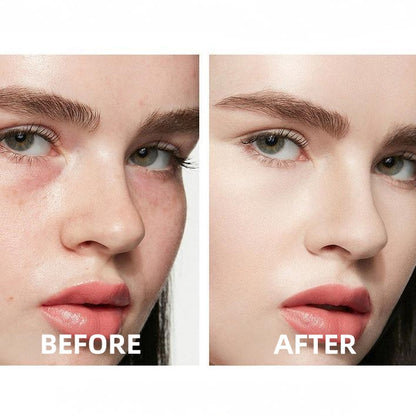 🔥Insideefy™ All-Day Perfection Concealer-Hydrating, Long-lasting Coverage & Natural Finish