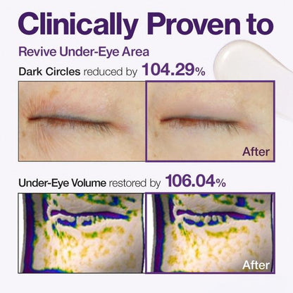 🔥Insideefy™ Firm & Bright Eye Cream-with NAD+, Peptides, and Retinol, Targeting Dark Circles, Wrinkles, and Puffiness