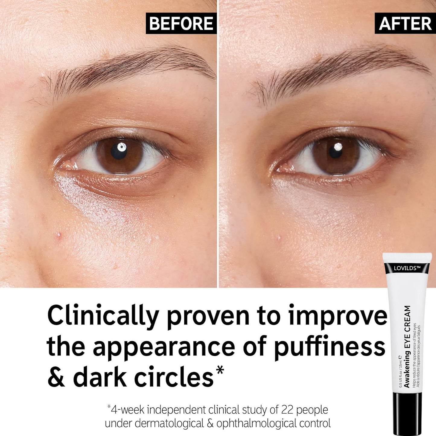 🔥LOVILDS™ Awakening Eye Cream – Wrinkle Smoothing & Dark Circle Brightening
