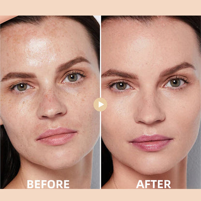 🔥Medazy™ Hydrating Concealer– Seamless Coverage & Deep Moisture