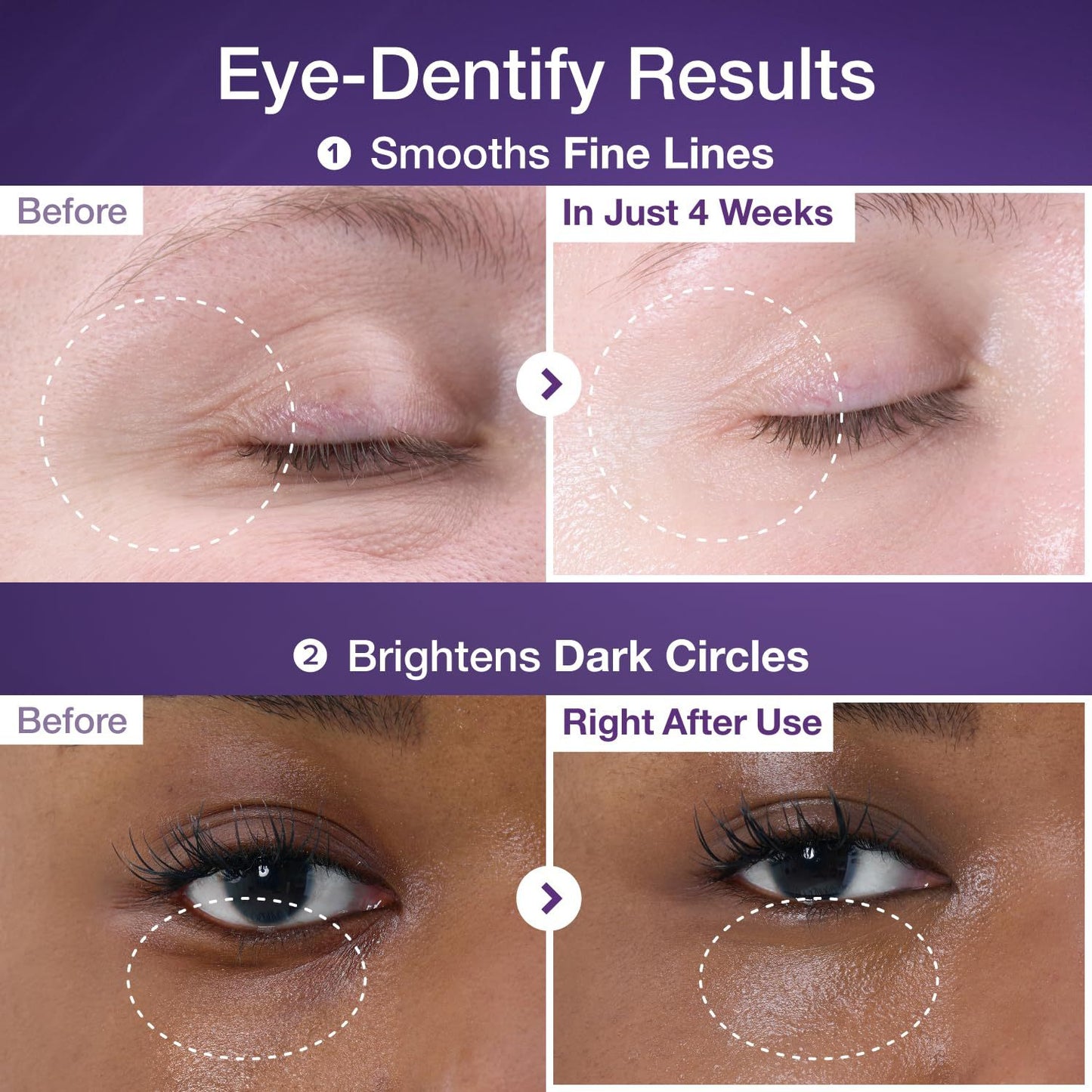🔥Insideefy™ Firm & Bright Eye Cream-with NAD+, Peptides, and Retinol, Targeting Dark Circles, Wrinkles, and Puffiness