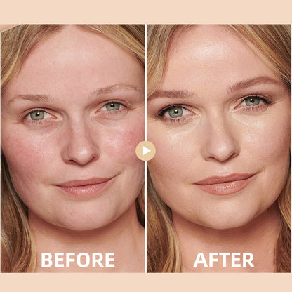 🔥Medazy™ Hydrating Concealer– Seamless Coverage & Deep Moisture