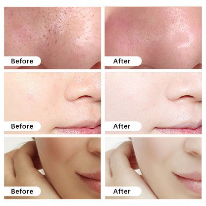 LOVILDS™ Microdermabrasion Facial Scrub and Face Mask