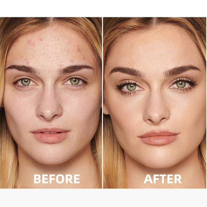 🔥Medazy™ Nourishing Skincare BB Cream-Flawless Coverage, Oil Control & SPF20