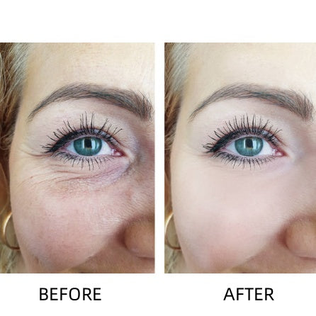 🔥LOVILDS™ Awakening Eye Cream – Wrinkle Smoothing & Dark Circle Brightening