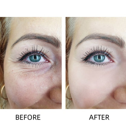 🔥LOVILDS™ Awakening Eye Cream – Wrinkle Smoothing & Dark Circle Brightening