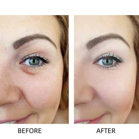 🔥Insideefy™ Revitalizing Eye Cream – Brightening, Firming & Anti-Aging