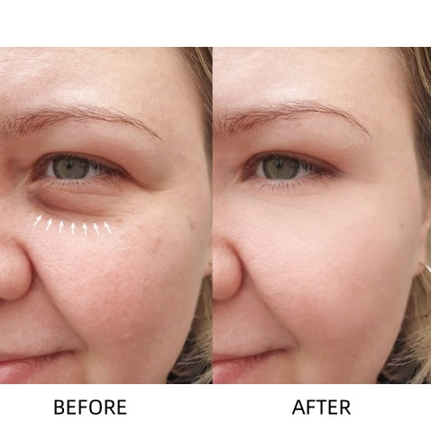 🔥Insideefy™ Revitalizing Eye Cream – Brightening, Firming & Anti-Aging