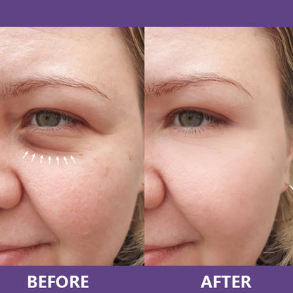 🔥Insideefy™ Firm & Bright Eye Cream-with NAD+, Peptides, and Retinol, Targeting Dark Circles, Wrinkles, and Puffiness