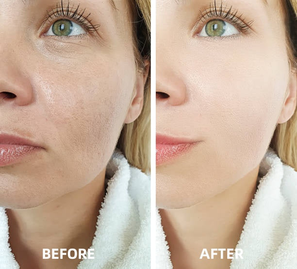 🔥LOVILDS™ Active Volcanic Mineral Clay Mask-Pore Cleansing & Oil Balancing
