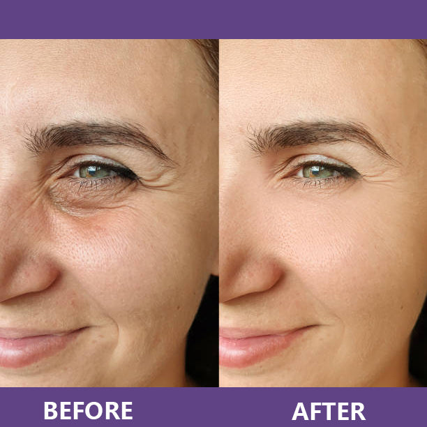 🔥Insideefy™ Firm & Bright Eye Cream-with NAD+, Peptides, and Retinol, Targeting Dark Circles, Wrinkles, and Puffiness