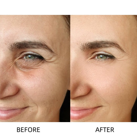 🔥Insideefy™ Revitalizing Eye Cream – Brightening, Firming & Anti-Aging