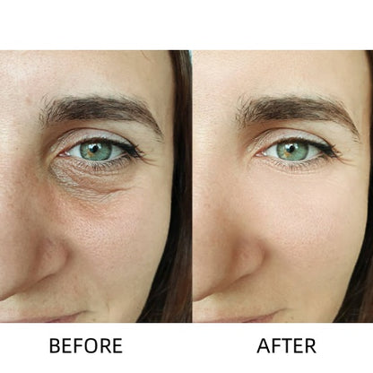 🔥LOVILDS™ Awakening Eye Cream – Wrinkle Smoothing & Dark Circle Brightening