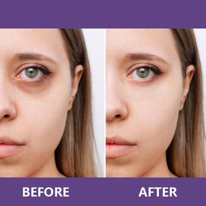 🔥Insideefy™ Firm & Bright Eye Cream-with NAD+, Peptides, and Retinol, Targeting Dark Circles, Wrinkles, and Puffiness