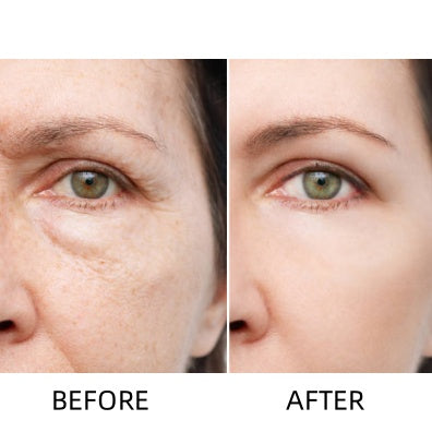 🔥LOVILDS™ Awakening Eye Cream – Wrinkle Smoothing & Dark Circle Brightening